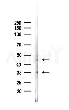 CD63 Antibody - Western blot analysis of lysates from A2780 cells(LPS 4h treatment), using CD63 Antibody at 1/1000 dilution.