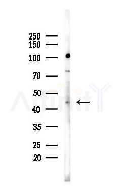CD63 Antibody - Western blot analysis of lysates from 293 cells(heat-shock 45min treatment), using CD63 Antibody at 1/1000 dilution.