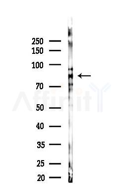 PI3K p85 alpha Antibody - Western blot analysis of lysates from Hela cells(starvation 24h treatment), using PI3K p85 alpha Antibody at 1/1000 dilution.