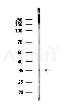 CD57 Antibody - Western blot analysis of lysates from PC12 cells(starvation 24h treatment), using CD57 Antibody at 1/1000 dilution.