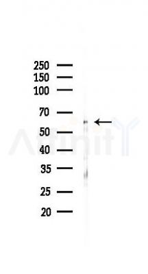 Beclin 1 Antibody - Western blot analysis of lysates from Rat lung, using Beclin 1 Antibody at 1/1000 dilution.