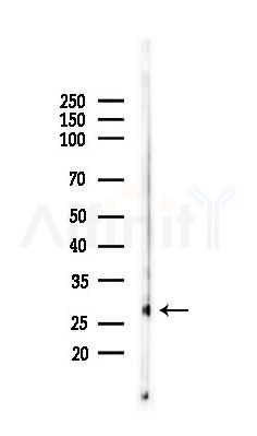 VEGFA Antibody - Western blot analysis of lysates from Rat kidney, using VEGFA Antibody at 1/1000 dilution.