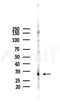 Connexin 32 Antibody - Western blot analysis of lysates from PC12 cells(LPS 4h treatment), using Connexin 32 Antibody at 1/1000 dilution.