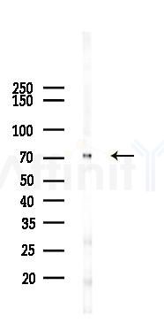 AFP Antibody - Western blot analysis of lysates from PC12 cells(LPS 4h treatment), using AFP Antibody at 1/1000 dilution.