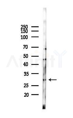 SIRT3 Antibody - Western blot analysis of lysates from Hela cells(starvation 24h treatment), using SIRT3 Antibody at 1/1000 dilution.