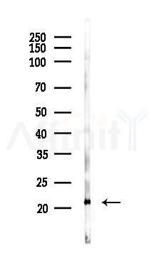 CD8B Antibody - Western blot analysis of lysates from Mouse lung, using CD8B Antibody at 1/1000 dilution.