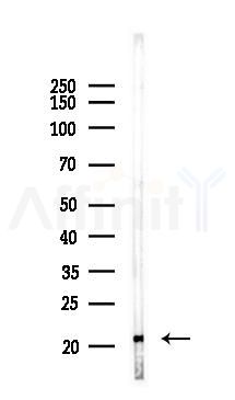 CD8B Antibody - Western blot analysis of lysates from Hela cells(heat-shock 45min treatment), using CD8B Antibody at 1/1000 dilution.