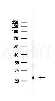 CD9 Antibody - Western blot analysis of lysates from Mouse heart, using CD9 Antibody at 1/1000 dilution.