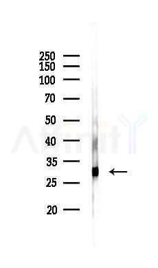CD9 Antibody - Western blot analysis of lysates from Rat liver, using CD9 Antibody at 1/1000 dilution.