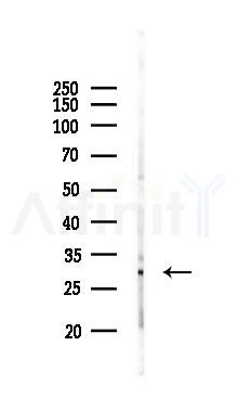 IL4 Antibody - Western blot analysis of lysates from Rat lung, using IL4 Antibody at 1/1000 dilution.