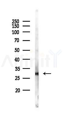 IL4 Antibody - Western blot analysis of lysates from Rat liver, using IL4 Antibody at 1/1000 dilution.