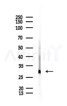 IL4 Antibody - Western blot analysis of lysates from Rat kidney, using IL4 Antibody at 1/1000 dilution.