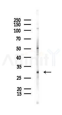 IL4 Antibody - Western blot analysis of lysates from PC12 cells(UV 30min treatment), using IL4 Antibody at 1/1000 dilution.
