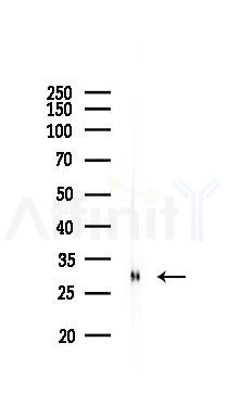 IL4 Antibody - Western blot analysis of lysates from Rat kidney, using IL4 Antibody at 1/1000 dilution.