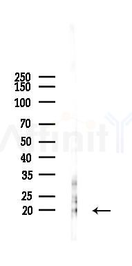 Trefoil factor 2/TFF2 Antibody - Western blot analysis of lysates from PC12 cells(LPS 4h treatment), using Trefoil factor 2/TFF2 Antibody at 1/1000 dilution.
