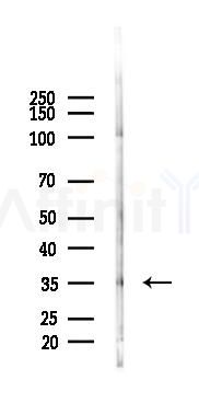 NGF Antibody - Western blot analysis of lysates from Mouse lung, using NGF Antibody at 1/1000 dilution.