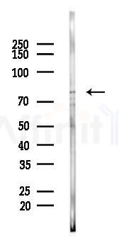 ABCG2 Antibody - Western blot analysis of lysates from A2780 cells(LPS 4h treatment), using ABCG2 Antibody at 1/1000 dilution.