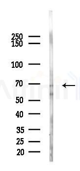 ABCG2 Antibody - Western blot analysis of lysates from Mouse lung, using ABCG2 Antibody at 1/1000 dilution.