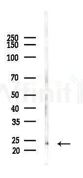 Interferon gamma Antibody - Western blot analysis of lysates from A2780 cells(LPS 4h treatment), using Interferon gamma Antibody at 1/1000 dilution.