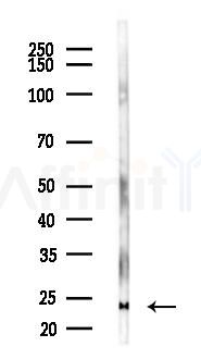 Interferon gamma Antibody - Western blot analysis of lysates from 293 cells(heat-shock 45min treatment), using Interferon gamma Antibody at 1/1000 dilution.