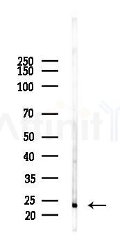 Interferon gamma Antibody - Western blot analysis of lysates from Mouse lung, using Interferon gamma Antibody at 1/1000 dilution.