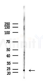 Interferon gamma Antibody - Western blot analysis of lysates from Rat testis, using Interferon gamma Antibody at 1/1000 dilution.