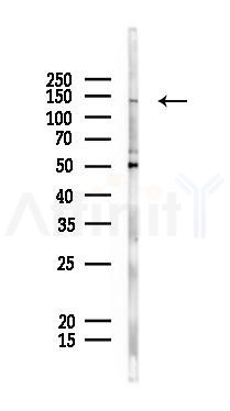 MDR1 Antibody - Western blot analysis of lysates from K562 cells(starvation 24h treatment), using P Glycoprotein 1（MDR1） Antibody at 1/1000 dilution.