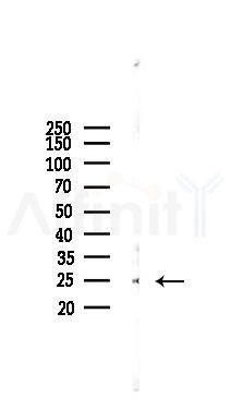 Cathepsin B Antibody - Western blot analysis of lysates from HUVEC cells(starvation 24h treatment), using Cathepsin B Antibody at 1/1000 dilution.