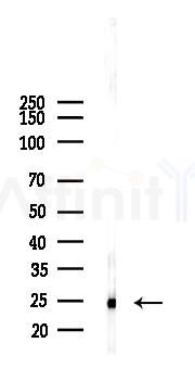 Cathepsin B Antibody - Western blot analysis of lysates from Mouse lung, using Cathepsin B Antibody at 1/1000 dilution.