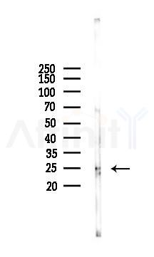 Cathepsin D Antibody - Western blot analysis of lysates from HUVEC cells(starvation 24h treatment), using Cathepsin D Antibody at 1/1000 dilution.