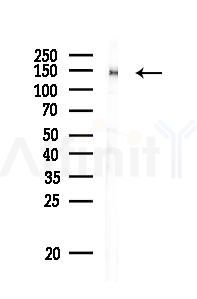 ACE1 Antibody - Western blot analysis of lysates from PC12 cells(LPS 4h treatment), using ACE1 Antibody at 1/1000 dilution.