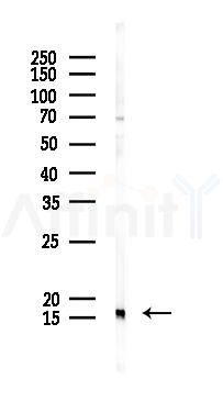 TOMM20 Antibody - Western blot analysis of lysates from K562 cells(starvation 24h treatment), using TOMM20 Antibody at 1/1000 dilution.