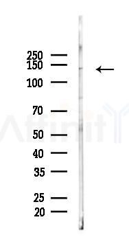 TYK2 Antibody - Western blot analysis of lysates from A2780 cells(LPS 4h treatment), using TYK2 Antibody at 1/1000 dilution.