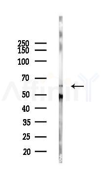 Elastin Antibody - Western blot analysis of lysates from Mouse lung, using Elastin Antibody at 1/1000 dilution.