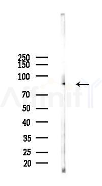 MMP9 Antibody - Western blot analysis of lysates from Mouse lung, using MMP9 Antibody at 1/1000 dilution.