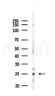 CD83 Antibody - Western blot analysis of lysates from PC12 cells(LPS 4h treatment), using CD83 Antibody at 1/1000 dilution.