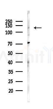 EPHA2 Antibody - Western blot analysis of lysates from Rat brain, using EPHA2 Antibody at 1/1000 dilution.