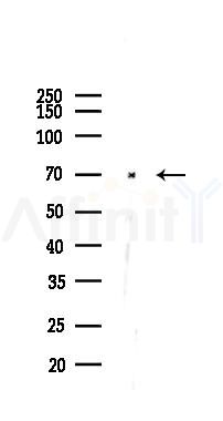 Keap1 Antibody - Western blot analysis of lysates from Rat lung, using Keap1 Antibody at 1/1000 dilution.