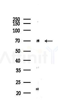 Keap1 Antibody - Western blot analysis of lysates from Hela cells(starvation 24h treatment), using Keap1 Antibody at 1/1000 dilution.
