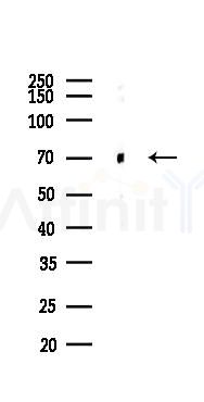Keap1 Antibody - Western blot analysis of lysates from PC12 cells(UV 30min treatment), using Keap1 Antibody at 1/1000 dilution.