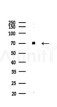 Keap1 Antibody - Western blot analysis of lysates from COLO205 cells(UV 30min treatment), using Keap1 Antibody at 1/1000 dilution.