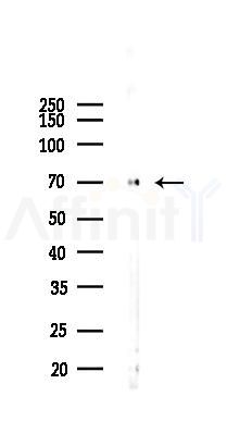 Keap1 Antibody - Western blot analysis of lysates from A2780 cells(LPS 4h treatment), using Keap1 Antibody at 1/1000 dilution.