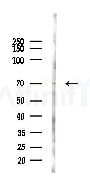 Keap1 Antibody - Western blot analysis of lysates from 293 cells(heat-shock 45min treatment), using Keap1 Antibody at 1/1000 dilution.