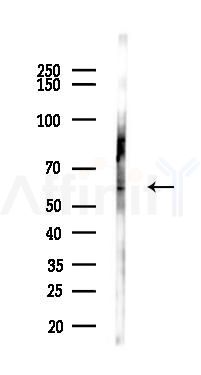 Keap1 Antibody - Western blot analysis of lysates from K562 cells(LPS 4h treatment), using Keap1 Antibody at 1/1000 dilution.