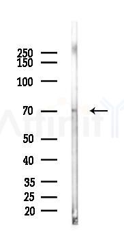 ACHE Antibody - Western blot analysis of lysates from 293 cells(heat-shock 45min treatment), using ACHE Antibody at 1/1000 dilution.