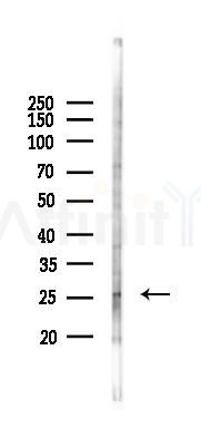 Bim Antibody - Western blot analysis of lysates from Mouse lung, using Bim Antibody at 1/1000 dilution.