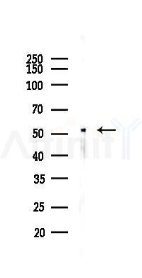 PPAR  alpha Antibody - Western blot analysis of lysates from RAW264.