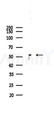 PPAR  alpha Antibody - Western blot analysis of lysates from COLO205 cells(UV 30min treatment), using PPAR  alpha Antibody at 1/1000 dilution.
