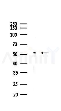 PPAR  alpha Antibody - Western blot analysis of lysates from K562 cells(LPS 4h treatment), using PPAR  alpha Antibody at 1/1000 dilution.