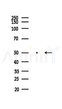 PPAR  alpha Antibody - Western blot analysis of lysates from Rat kidney, using PPAR  alpha Antibody at 1/1000 dilution.